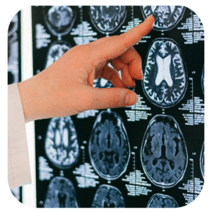 Neurologia