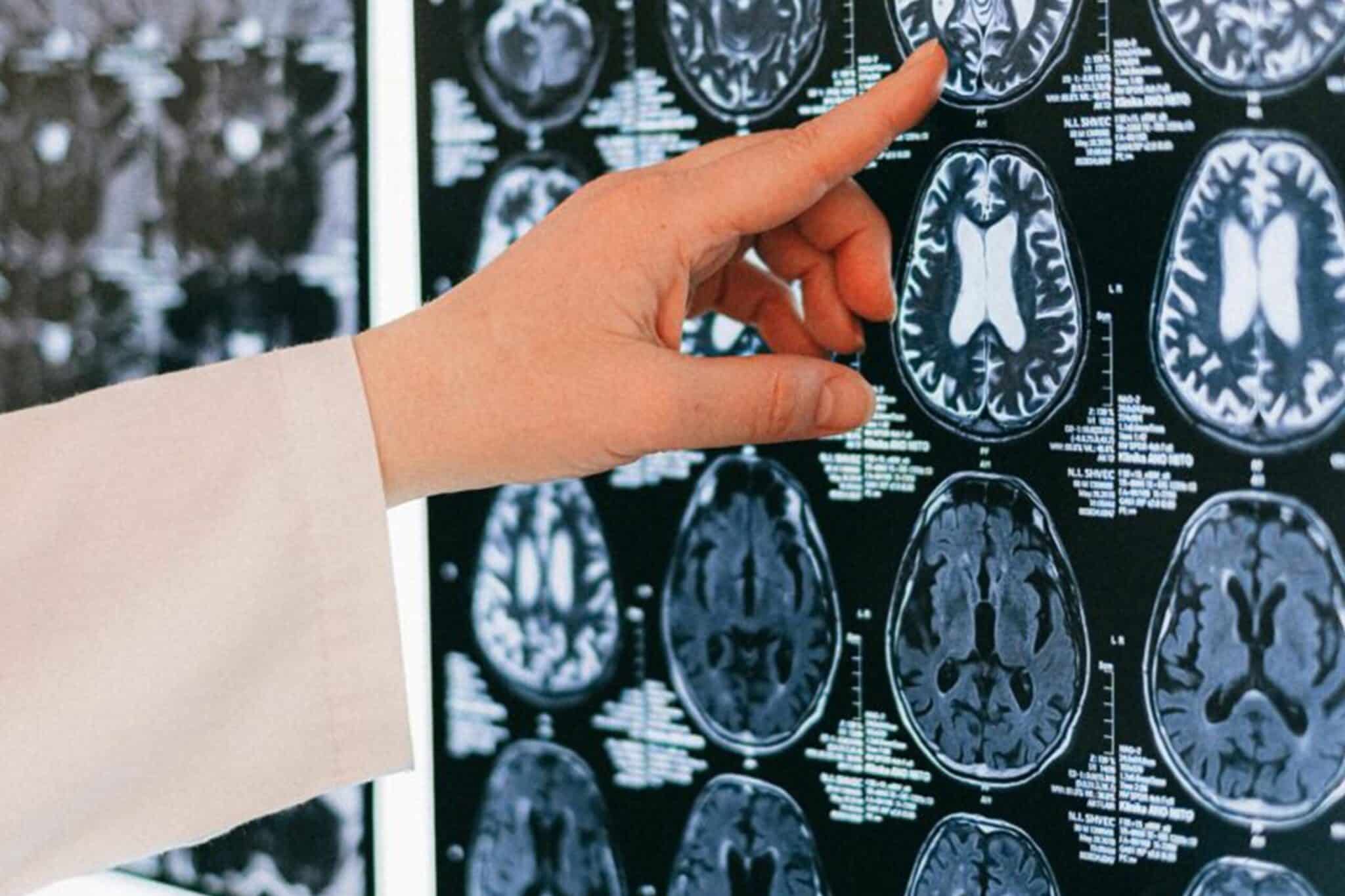Neurologia geral